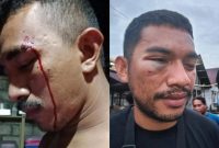 Rantino dan Vicko korban pengeroyokan di kawasan Tiabo, Loloda Tengah. (Istimewa)