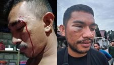 Rantino dan Vicko korban pengeroyokan di kawasan Tiabo, Loloda Tengah. (Istimewa)